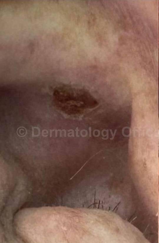 SRT-100 Before and After Case 4 Before