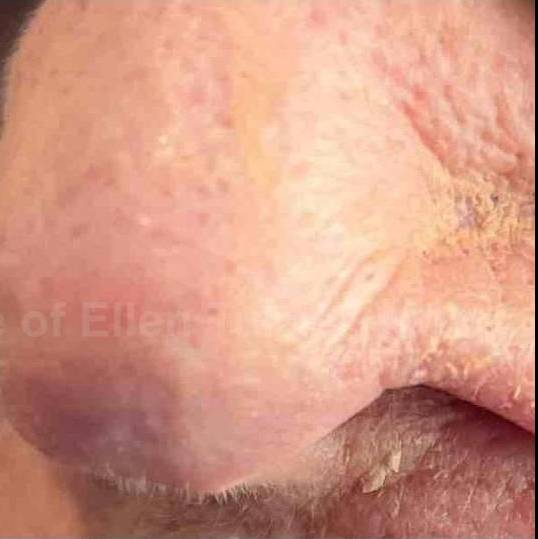 SRT-100 Before and After Case 21 After