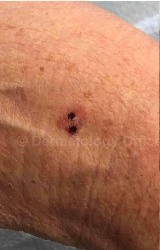 SRT-100 Before and After Case 29 Before